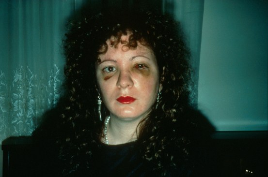 Nan-Goldin-Battered